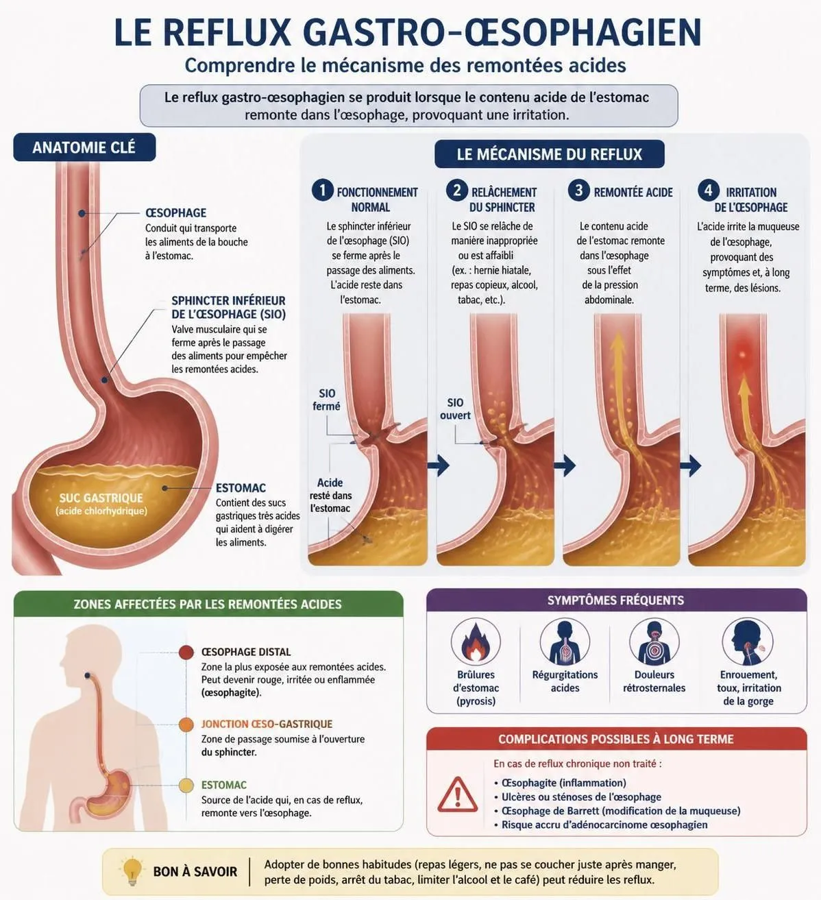 découvrez les causes du reflux gastro-œsophagien, les traitements efficaces et les conseils alimentaires pour soulager ce trouble digestif et améliorer votre confort au quotidien.