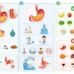 découvrez les causes du reflux gastro-œsophagien, les traitements efficaces et les conseils alimentaires pour mieux gérer et soulager ce trouble digestif.
