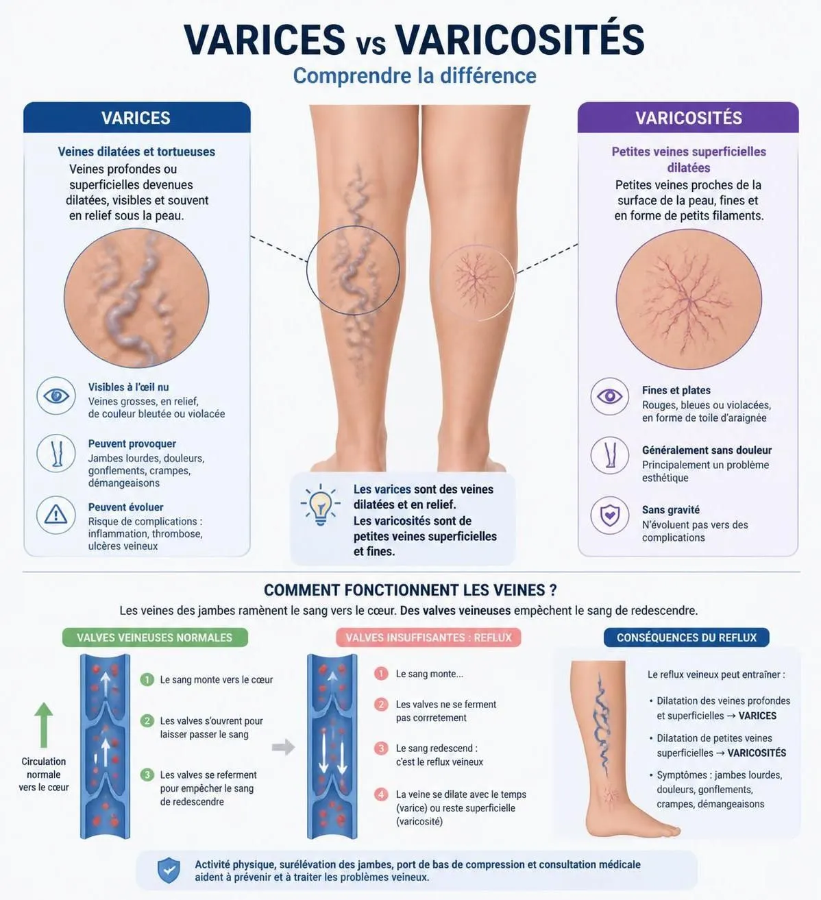 découvrez les causes, symptÎmes et traitements des varices pour soulager efficacement vos jambes et améliorer votre confort au quotidien.